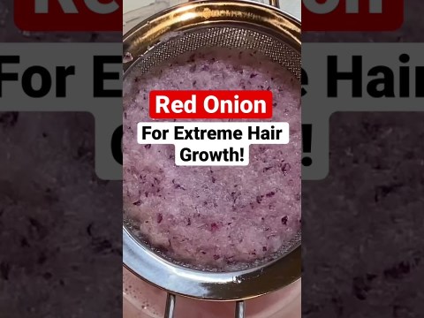 RED ONION JUICE FOR EXTREME HAIR GROWTH! Prevent Dandruff, #SEBORRHEICDERMATITIS #ONIONJUICE #4C RED ONION JUICE FOR EXTREME HAIR GROWTH! Prevent Dandruff, #SEBORRHEICDERMATITIS #ONIONJUICE #4C