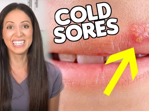 What are COLD SORES & How To Get Rid of Them What are COLD SORES & How To Get Rid of Them