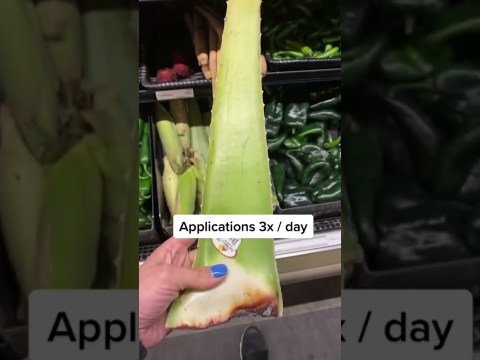 Natural remedies for cold sores #holistichealth #shorts #remedies Natural remedies for cold sores #holistichealth #shorts #remedies