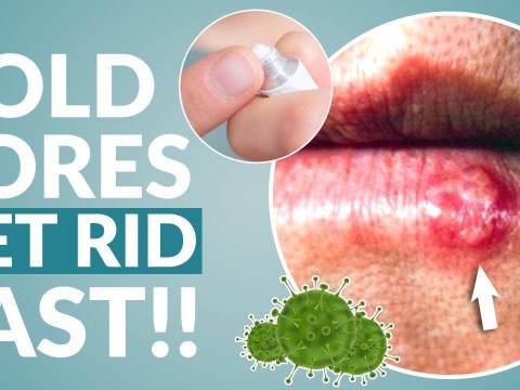 How to Get Rid of Cold Sore Fast How to Get Rid of Cold Sore Fast