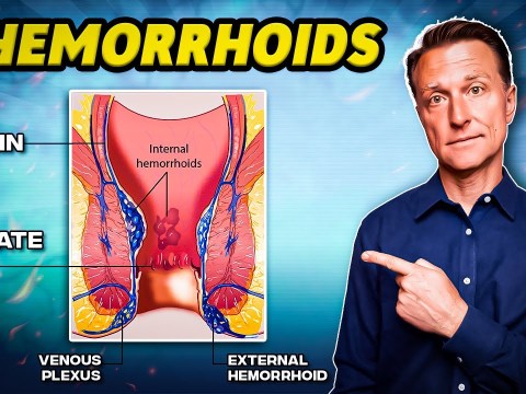 The #1 Best Remedy for Hemorrhoids – Dr. Berg The #1 Best Remedy for Hemorrhoids – Dr. Berg