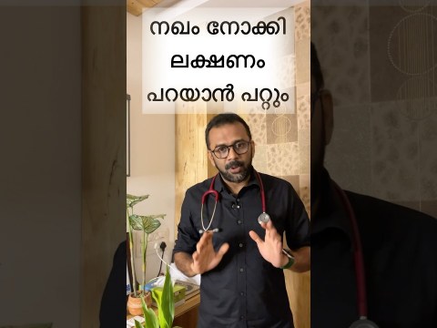 നഖം നോക്കി അസുഖം കണ്ടുപിടിച്ചാലോ🤔| Alarming Nail Signs‼️ #nails #signs #shorts നഖം നോക്കി അസുഖം കണ്ടുപിടിച്ചാലോ🤔| Alarming Nail Signs‼️ #nails #signs #shorts