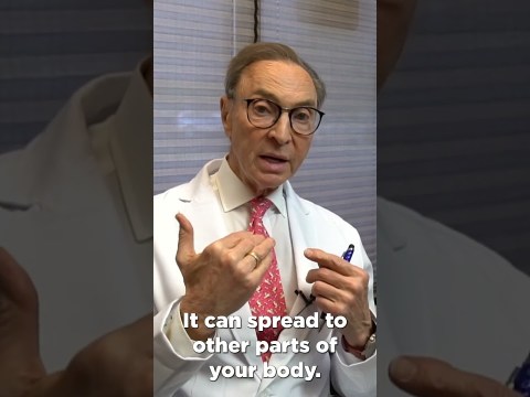 How to Treat Candida at Home: Doctors Advice #dentist #dentalhygiene #candida How to Treat Candida at Home: Doctors Advice #dentist #dentalhygiene #candida