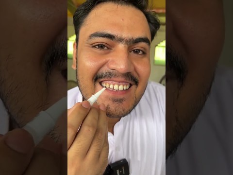 Ultra Instant Teeth Whitening Stick Review Ultra Instant Teeth Whitening Stick Review