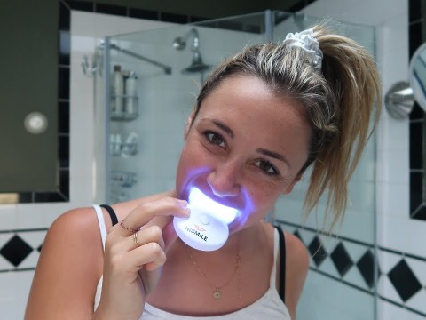 Do at-home teeth whitening kits really work? | Glam Lab Do at-home teeth whitening kits really work? | Glam Lab