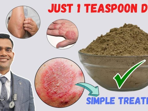 Just 1 Teaspoon Daily To Cure all Your Skin Problems | Eczema – Simple Treatment Just 1 Teaspoon Daily To Cure all Your Skin Problems | Eczema – Simple Treatment