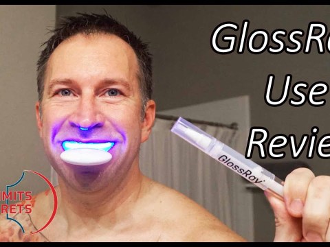 Does TEETH WHITENING WORK? By GLOSSRAY Customer AT HOME Teeth Whitening Does TEETH WHITENING WORK? By GLOSSRAY Customer AT HOME Teeth Whitening