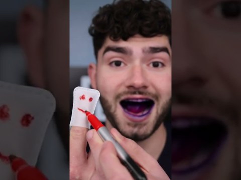 Deep Cleaning Teeth Wipe! #shorts Deep Cleaning Teeth Wipe! #shorts