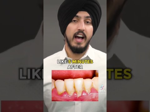 This Is Why Plaque Forms On Your Teeth so Quickly #shorts This Is Why Plaque Forms On Your Teeth so Quickly #shorts