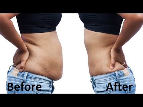 8 Home Remedies to Lose Belly Fat Without Exercise 8 Home Remedies to Lose Belly Fat Without Exercise