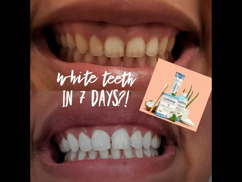 ORAL ESSENTILAS LUMINEUX REVIEW | WHITE TEETH IN 7 DAYS??? ORAL ESSENTILAS LUMINEUX REVIEW | WHITE TEETH IN 7 DAYS???