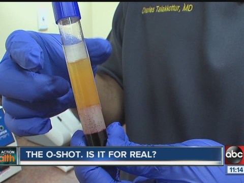 Local doctor says the O-Shot is improving women's sexual dysfunction Local doctor says the O-Shot is improving women's sexual dysfunction