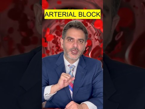 Best Arteriogenic Ed Treatment #sexualdysfunction Best Arteriogenic Ed Treatment #sexualdysfunction