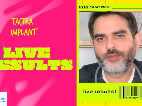 tactra implant live results in diabetes Erectile dysfunction patient – 2 days after surgery tactra implant live results in diabetes Erectile dysfunction patient – 2 days after surgery