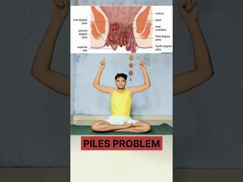 If you're suffering from piles, try this #piles #health #yoga #shortvideo #shorts #ytshorts #forword If you're suffering from piles, try this #piles #health #yoga #shortvideo #shorts #ytshorts #forword