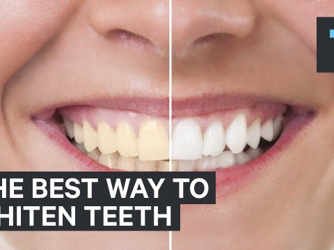 The best way to whiten teeth The best way to whiten teeth