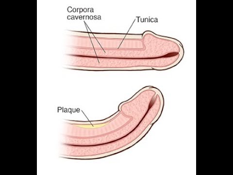 Penis Enlargement Foods (Top 6 foods fo bigger size naturally ) Penis Enlargement Foods (Top 6 foods fo bigger size naturally )