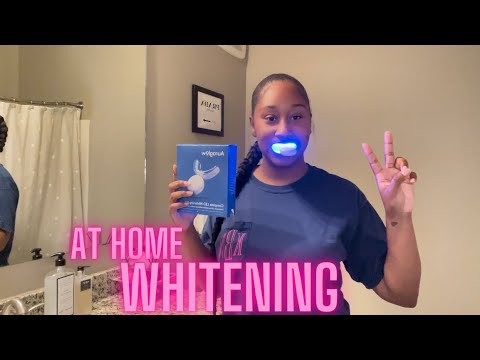 Whiten your teeth at home | Auraglow Teeth Whitening Review Whiten your teeth at home | Auraglow Teeth Whitening Review