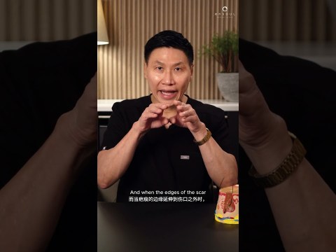 Treating Hypertrophic Scars and Keloids | Ensoul Medical Clinic Treating Hypertrophic Scars and Keloids | Ensoul Medical Clinic