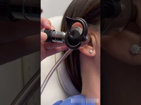 How an ENT Doctor Removes Ear Wax How an ENT Doctor Removes Ear Wax