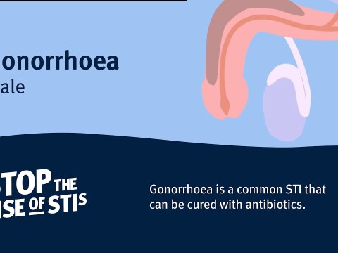 Sexual Health – Gonorrhoea (Male) Sexual Health – Gonorrhoea (Male)