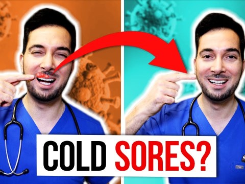 How to get rid of cold sores on lips fast and treatment How to get rid of cold sores on lips fast and treatment