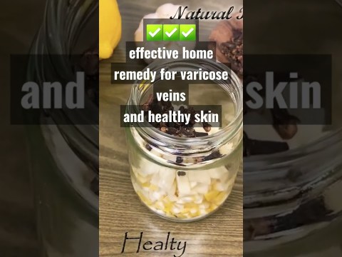 unbelievable!treat your varicose veins with this simple recipe. a treasure that everyone should have unbelievable!treat your varicose veins with this simple recipe. a treasure that everyone should have