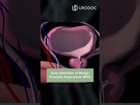 3 Reasons To Check Your Prostate 3 Reasons To Check Your Prostate