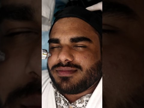 Men’s face lightening treatment & carbon hydra facial | Skinaa Clinic #shorts #viral Men’s face lightening treatment & carbon hydra facial | Skinaa Clinic #shorts #viral