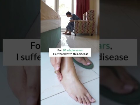 Cured My Arthritis in 3 Months | Left Doctors Shocked Cured My Arthritis in 3 Months | Left Doctors Shocked