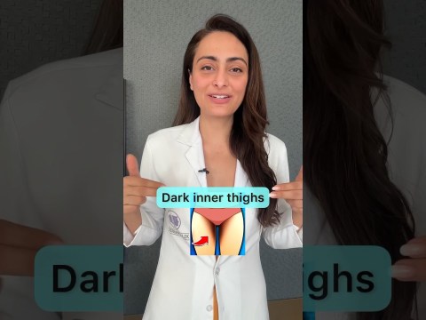 Dark inner thighs | causes and treatment | #dermatologist Dark inner thighs | causes and treatment | #dermatologist