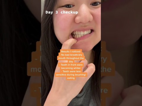 I Oil-Pulled For 30 Days! Here’s What Happened #oralhealth I Oil-Pulled For 30 Days! Here’s What Happened #oralhealth