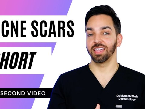 Acne Scars #shorts Acne Scars #shorts