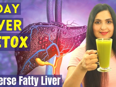 CLEANSE your FATTY LIVER, #GALLSTONES | Ayurvedic #LIVER #DETOX | Cleanse Your Liver Naturally CLEANSE your FATTY LIVER, #GALLSTONES | Ayurvedic #LIVER #DETOX | Cleanse Your Liver Naturally