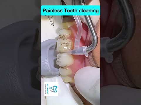 Painless Teeth Cleaning #shots Painless Teeth Cleaning #shots