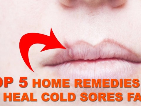 HOME REMEDY FOR COLD SORE- TOP 5 NATURAL REMEDIES TO CURE COLD SORES SUPER FAST HOME REMEDY FOR COLD SORE- TOP 5 NATURAL REMEDIES TO CURE COLD SORES SUPER FAST