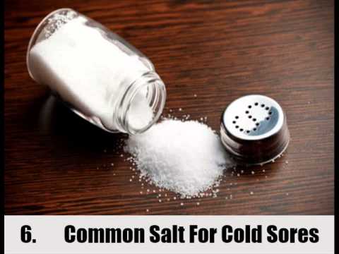 8 Home Remedies For Cold Sores In Mouth 8 Home Remedies For Cold Sores In Mouth