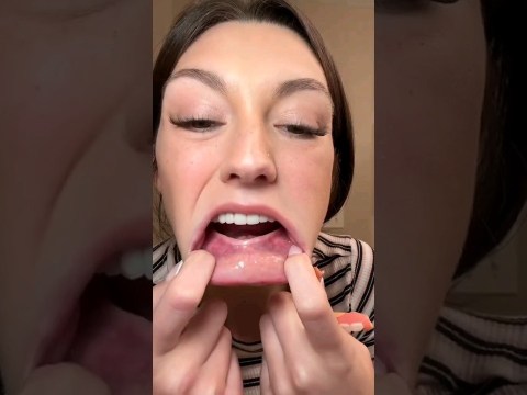 Cushion Grip FAQ: Will This Work On My Loose Lower Dentures? (Part 1) | By @cheychalai Cushion Grip FAQ: Will This Work On My Loose Lower Dentures? (Part 1) | By @cheychalai