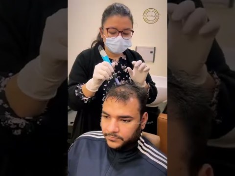 Mesogrow is the best treatment to get rid of hair fall | #hairfallcontrol #Shorts #youtubeshorts Mesogrow is the best treatment to get rid of hair fall | #hairfallcontrol #Shorts #youtubeshorts