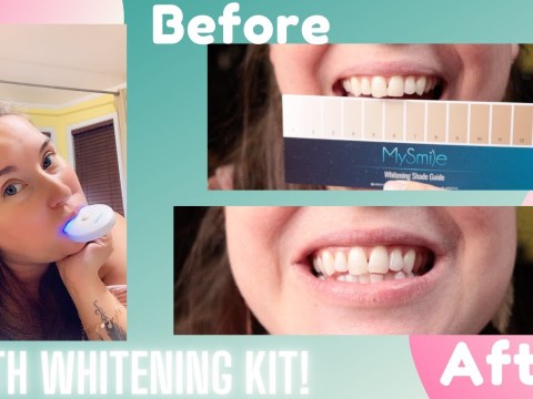 MySmile: Teeth Whitening Review MySmile: Teeth Whitening Review