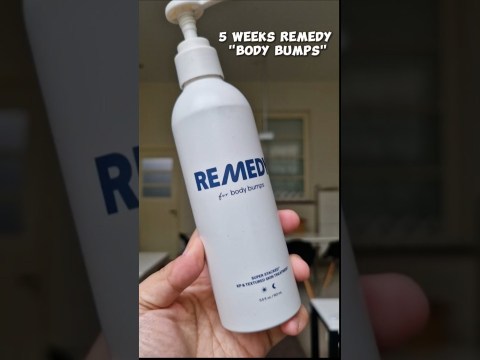 REMEDY SKIN FOR BODY REVIEW | treating my Keratosis pilaris REMEDY SKIN FOR BODY REVIEW | treating my Keratosis pilaris
