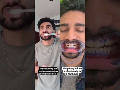 Sabka dentist recommends our revolutionary Teeth Cleaning & Whitening treatment for Strong teeth Sabka dentist recommends our revolutionary Teeth Cleaning & Whitening treatment for Strong teeth