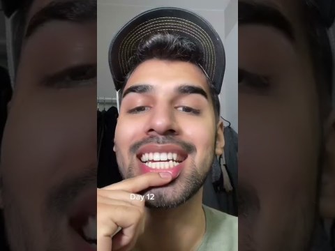 Trying a Crest Whitening strips for 20 days! #selfcare Trying a Crest Whitening strips for 20 days! #selfcare