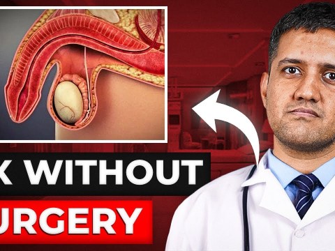 Erectile Dysfunction CURED in 6 Hours | Venous Leak Embolization | Dr. Gaurav Gangwani Erectile Dysfunction CURED in 6 Hours | Venous Leak Embolization | Dr. Gaurav Gangwani