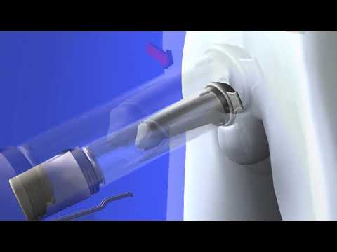 How to Use a Penis Pump How to Use a Penis Pump