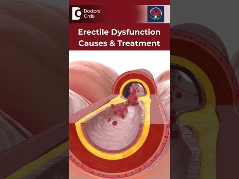 ERECTILE DYSFUNCTION – Major Causes and Treatment – Dr. Nagarajaiah N | Doctors' Circle#shorts ERECTILE DYSFUNCTION – Major Causes and Treatment – Dr. Nagarajaiah N | Doctors' Circle#shorts