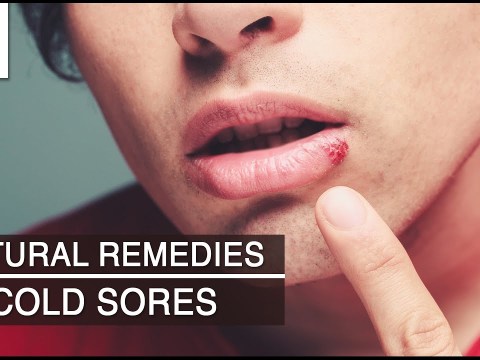 Skin Care – Cold Sores – Natural Ayurvedic Home Remedies Skin Care – Cold Sores – Natural Ayurvedic Home Remedies