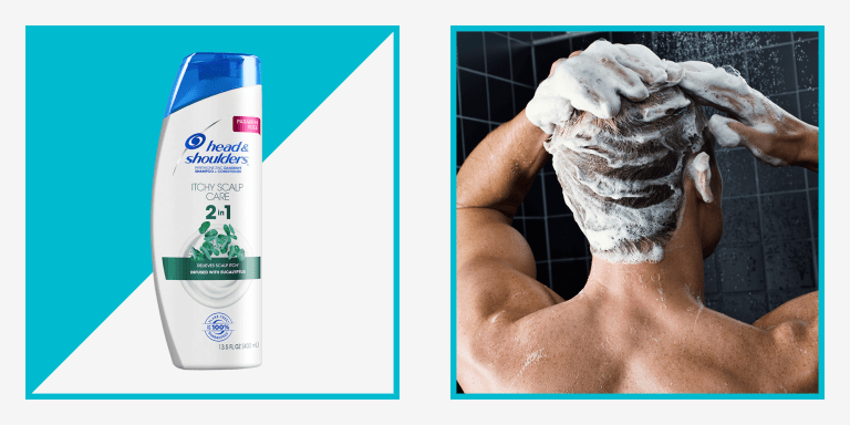 Best Shampoo for Itchy Scalp: Top Picks for 2025 Best Shampoo for Itchy Scalp: Top Picks for 2025