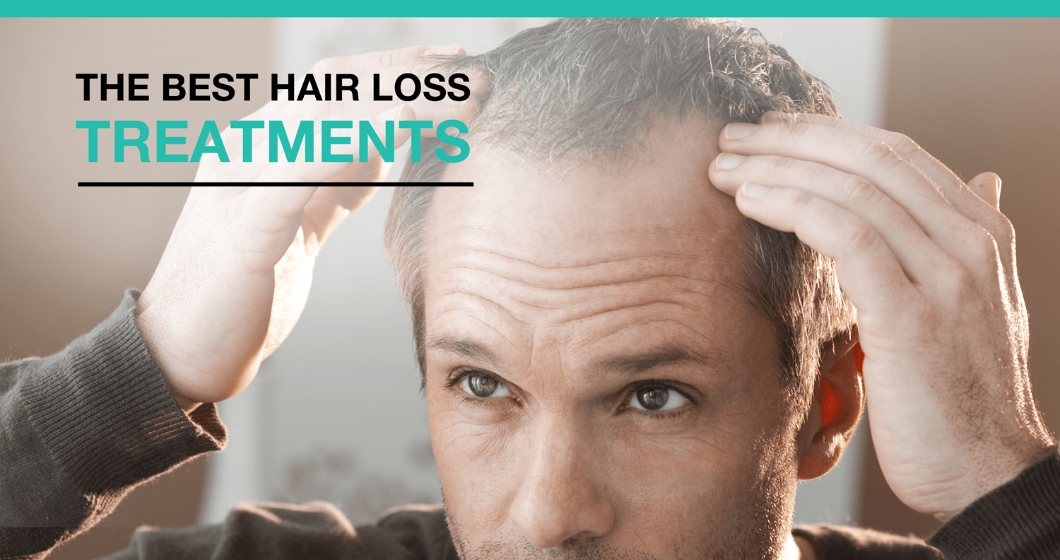 Best Hair Loss Treatment: Top Solutions for 2025 You Need to Try Best Hair Loss Treatment: Top Solutions for 2025 You Need to Try