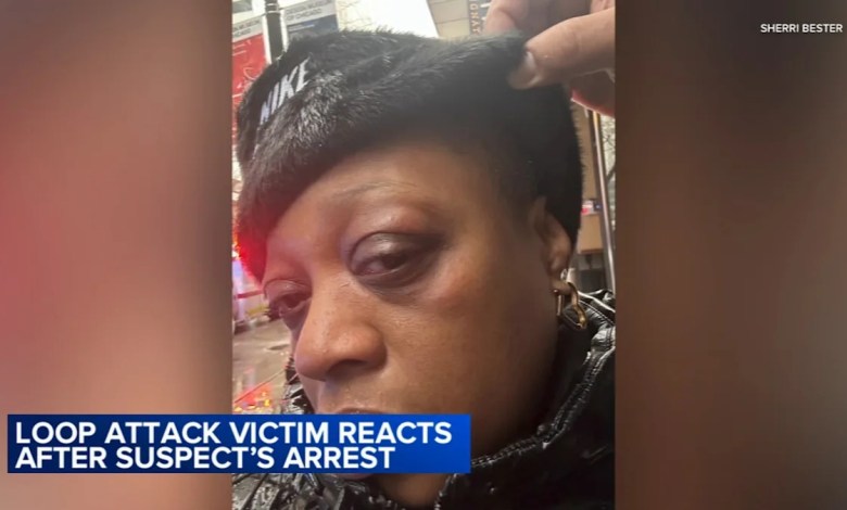 Alleged serial Loop puncher ordered detained after several attacks, some while wearing ankle monitor Alleged serial Loop puncher ordered detained after several attacks, some while wearing ankle monitor